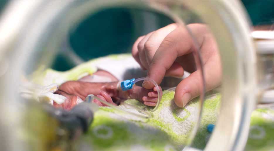 LE-COMPLICANZE-DEI-BIMBI-PRE-TERMINE